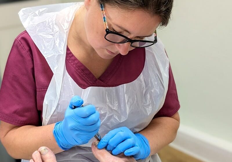 chapeltown-foot-clinic-sheffield-podiatry-chiropody-Lisa-nail-care Podiatrist Lisa Shaw of Chapeltown Foot Clinic, Sheffield treating a patient's nails, best foot treatment, boots foot treatment, podiatry treatment, podiatry services